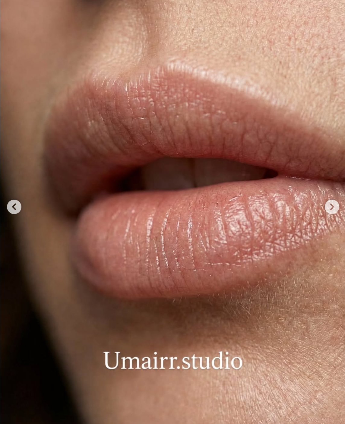Flawless skin